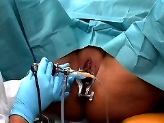 Bladder exam cystoscopy