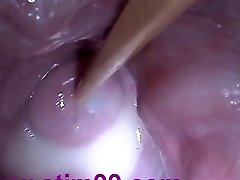 Insertion Semen Cum in Cervix Wide Stretching Pussy Plug