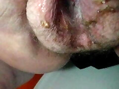 Very old grannie peeing Very old grannie peeing