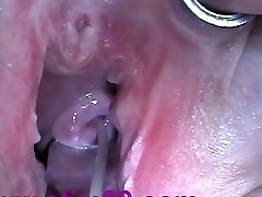 Cum Injection with Needle in Cervix Uterus after Shagging