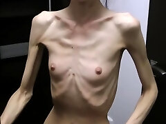 Anorexic Denisa posing and has ribs massaged