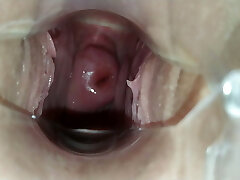 At the GYNECOLOGIST!! A plug in the girl's snatch!!