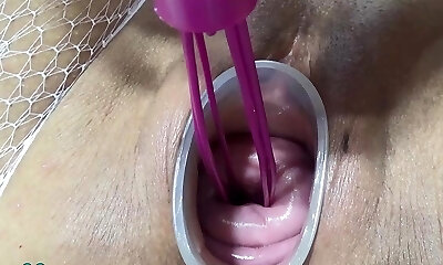 Mature wife pounding cervix and penetration in uterus