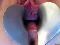 speculum court woman open pussy