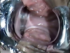 Insanely horny gynecologist inserts speculum into his patients pussy