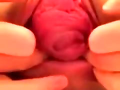 Vaginal mamadota omg Anal Prolapse On Webcam -