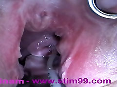Extreme xxlxx video new com Fisting, Huge Objects, Cervix Insertion, Peehole Fucking, Nettles, Electro Orgasms and Saline Injection