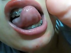 Mouth fetish braces