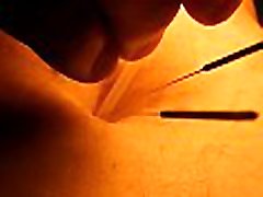 Belly Play piercing with acupuncture needles Belly Play piercing with acupuncture needles