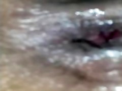 Anal gape Anal gape