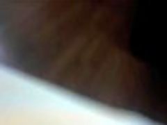 Painful anal Painful anal