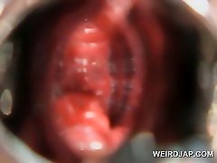 mbig tist asian gets hairy pussy opened with speculum