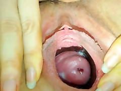 Woman showing her gaping baby vagina etting and cervix