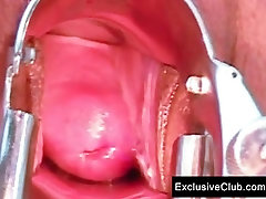 Tera hindi fist time sile pack pussy gyno gaping at clinic by old doctor