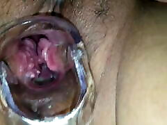 کاوش در داخل مهبل واژن