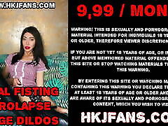 Huge XO speculum open to the max – addy lesbian star hole of Hotkinkjo.