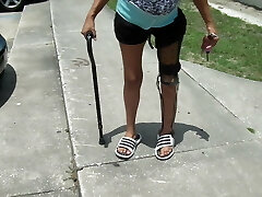 polio