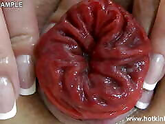 Fist and Rubber Fist at Once in Ass, Gape & Prolapse by Hotkinkyjo