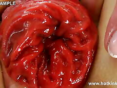 Big Black Plug in My mom scarqing Ass & Anal Prolapse by Hotkinkyjo