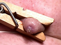 Leaky Nipple