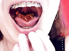 asmr comiendo osos de gelatina con frenillos por arya grander